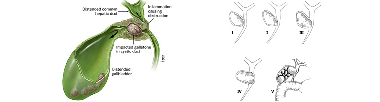 Gallbladder Drawing | Free download on ClipArtMag