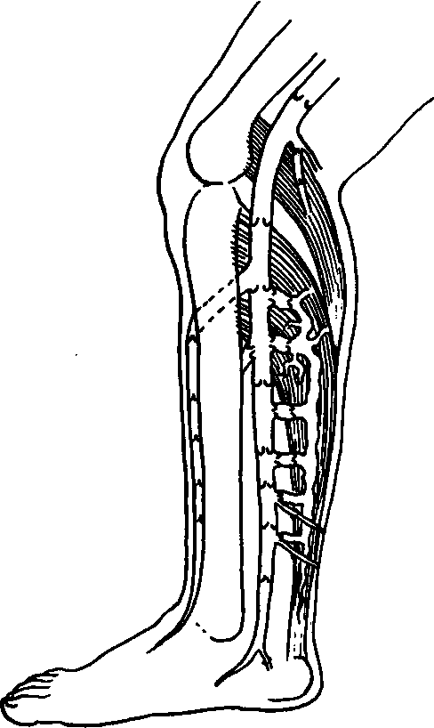 Veins Drawing | Free download on ClipArtMag