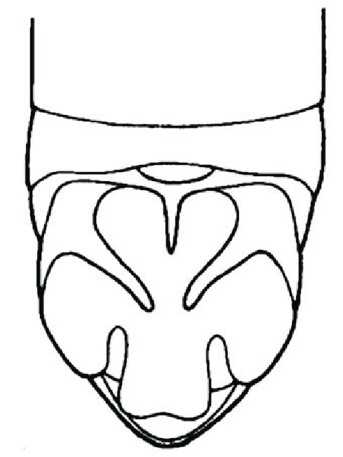 489x651 modified abdomen nymphius pravei