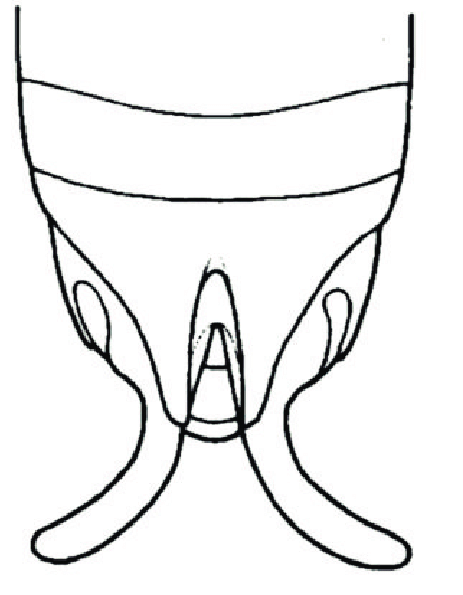 463x595 modified abdomen nymphius stylifer