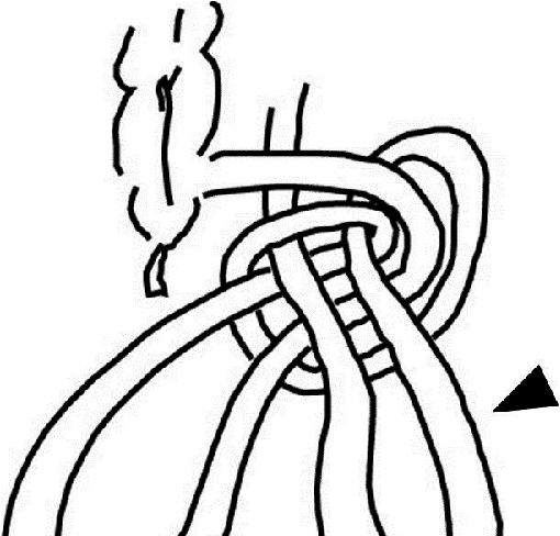510x488 sagittal ct imaging of abdomen showed a small intestine to form