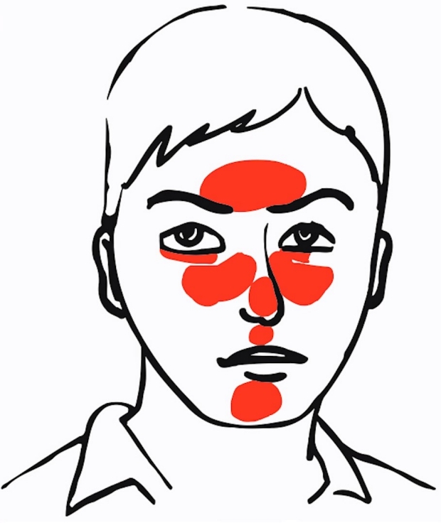 620x736 dermatology exam acne vs rosacea stanford medicine