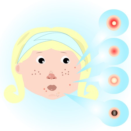 450x450 Ready Made Deisgns For Zit