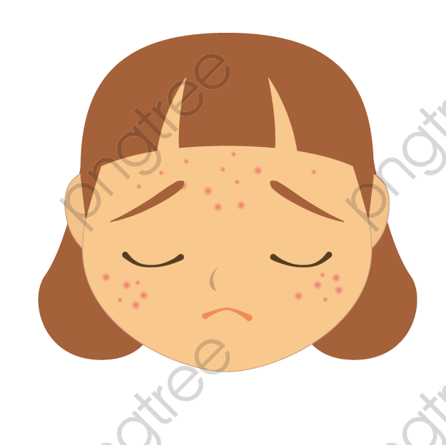 Collection of Acne clipart | Free download best Acne clipart on ...