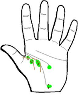 256x320 su jok acupuncture methods and treatment