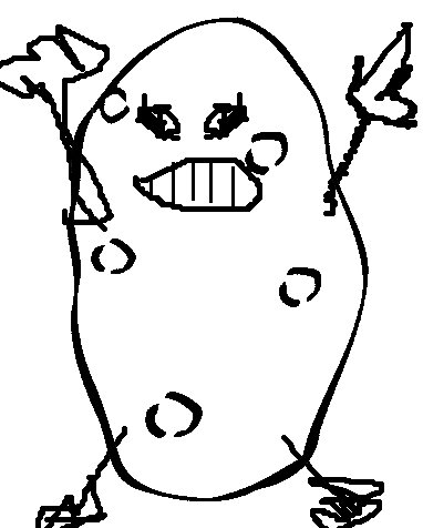 382x476 More Surprise Adhd Stress