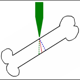 320x320 Detail Drawing Of Anvil With Notches For Femur Material