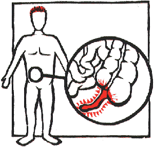 300x287 Is Your Appendix Useful Brethren Times