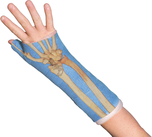 511x460 Collection Of Free Cast Drawing Plaster Download On Ui Ex