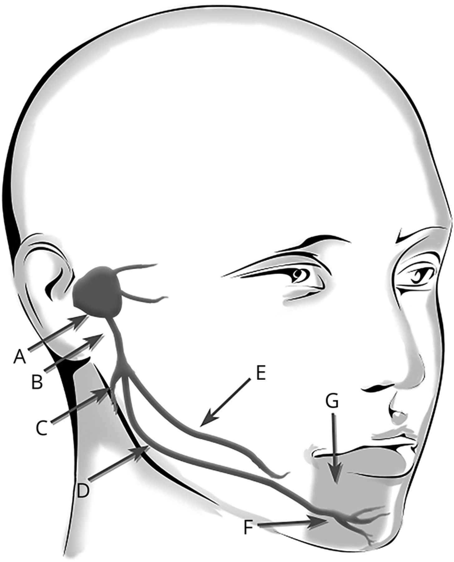 1455x1800 clinical reasoning a pregnant woman with chin numbness neurology