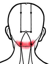 216x274 Headaches In The Back Of The Head
