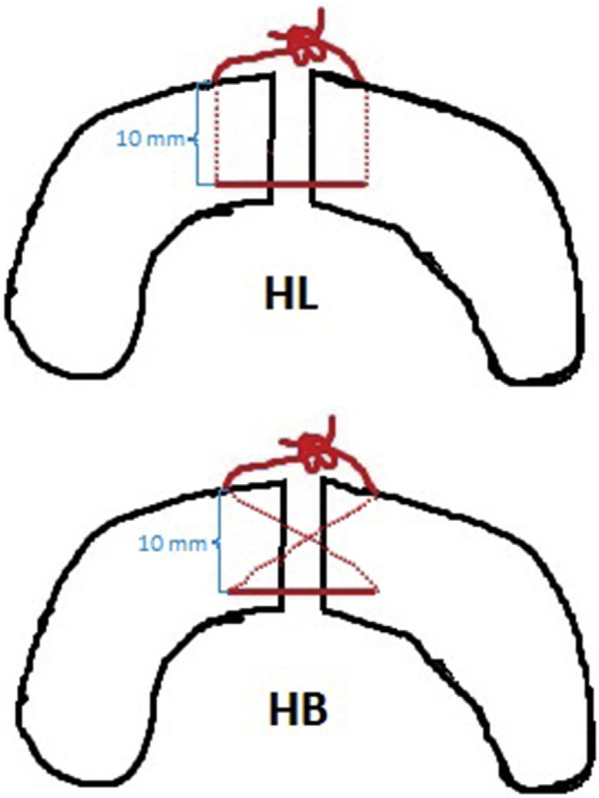 850x1133 Schematic Drawings Of Hl