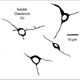 320x320 Camera Lucida Drawings Of Cb Immunoreactive Neurons