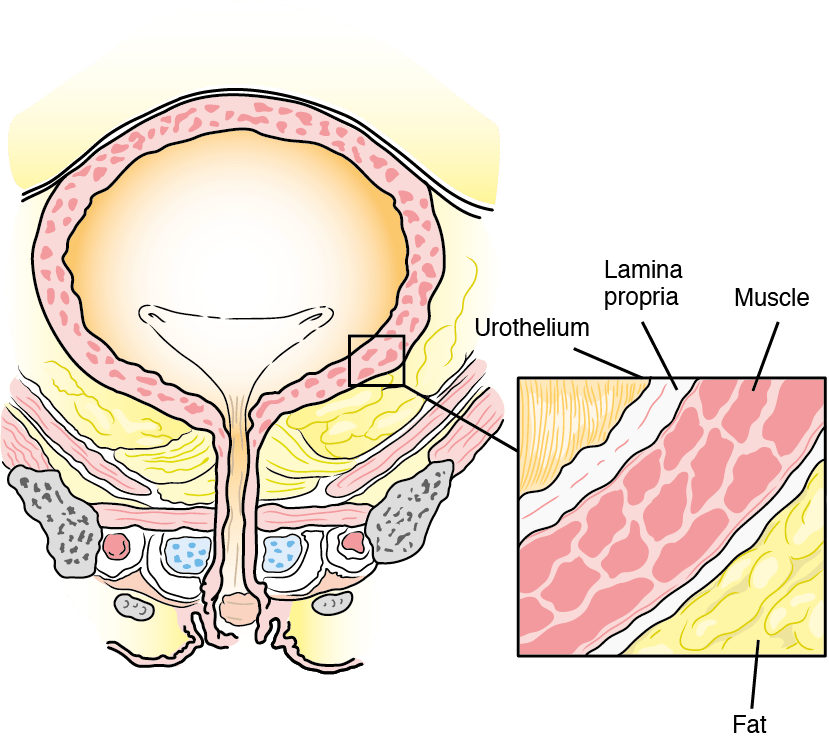 829x745 What Is Bladder Cancer General Information About The Bladder