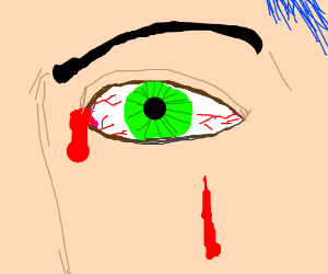 300x250 guy bleeding in his eye