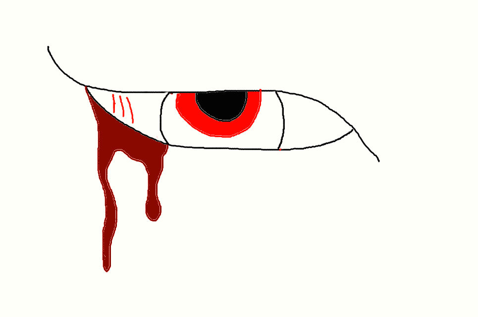 965x640 bleeding eye