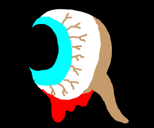 300x250 veiny, bleeding eyeball
