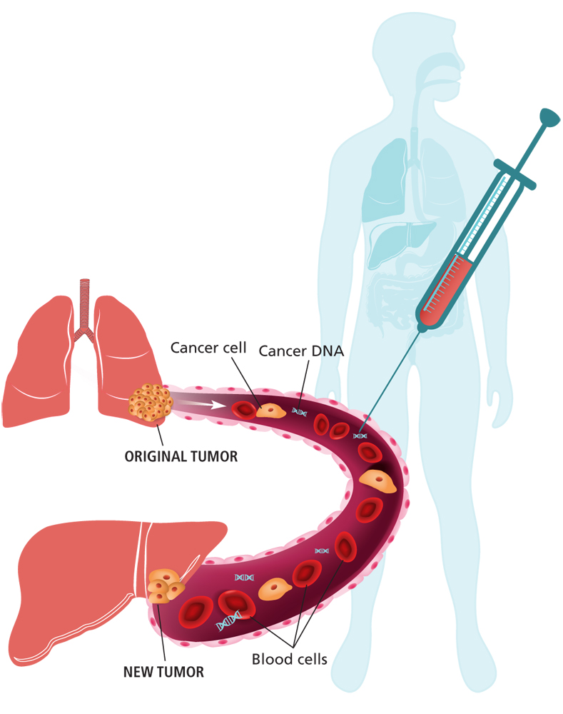 789x1000 A Blood Test May One Day Detect Early Stages Of Cancer