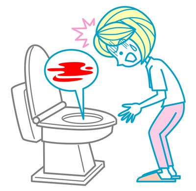 400x391 Why There's Blood In Your Stool And Next Steps