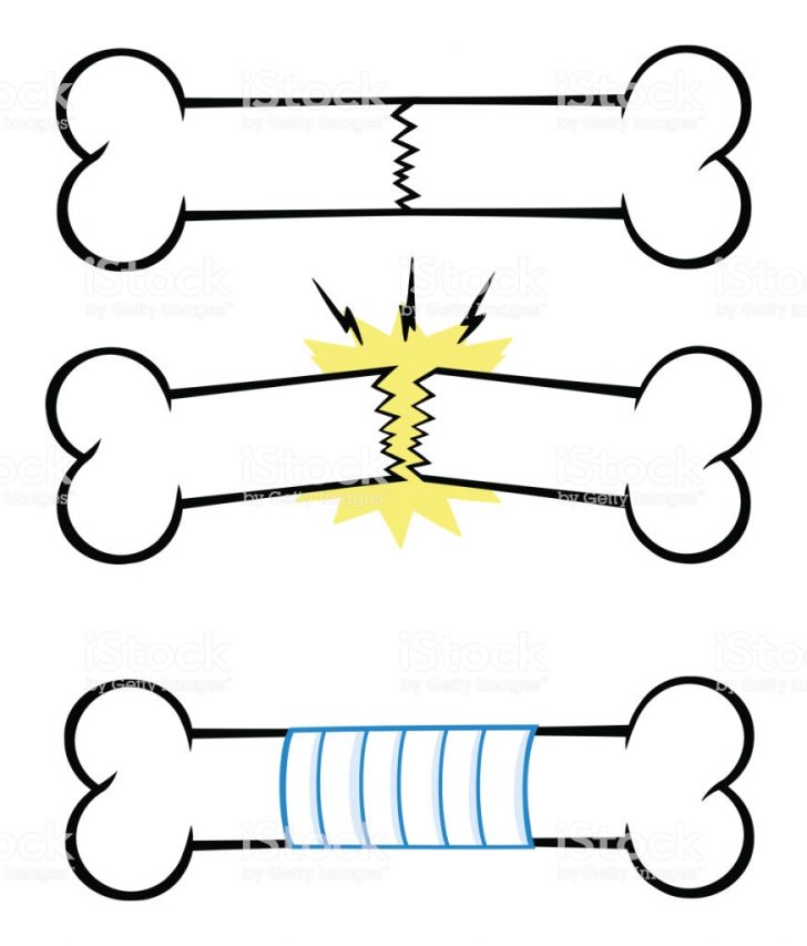 728x853 Bone Drawing Black And White Anatomy Structure Artists Marrow Clip