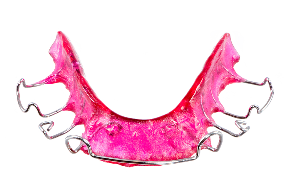 1000x667 Keeping Your Teeth Straight After Braces