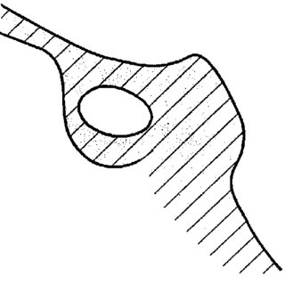 320x320 Drawing Showing A Sella Turcica Bridge, Type A Download