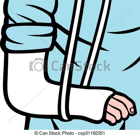 450x438 Cast On An Arm