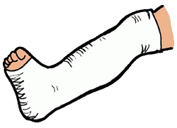 250x180 Collection Of Free Cast Drawing Leg Download On Ui Ex