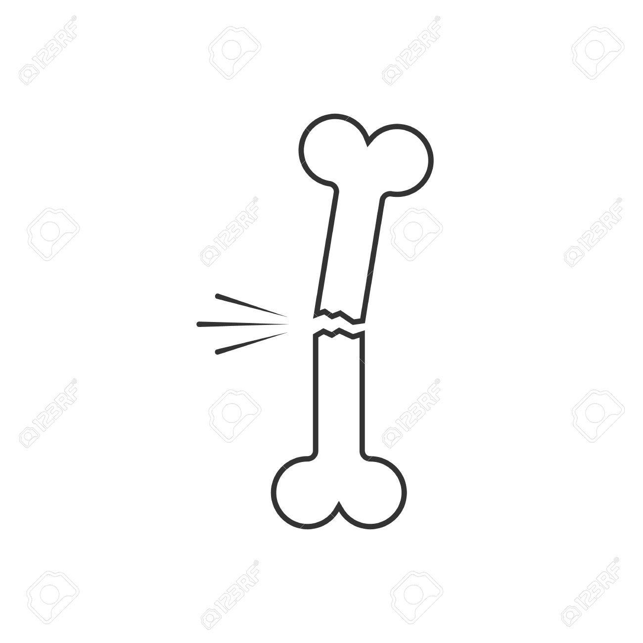 1300x1300 Broken Bone Clipart Backgrounds, Fogwlprs Drawing