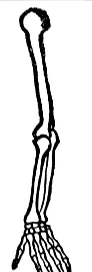 185x548 Broken Bone Clipart Free Download Clip Art