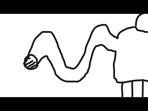 480x360 Broken Bones