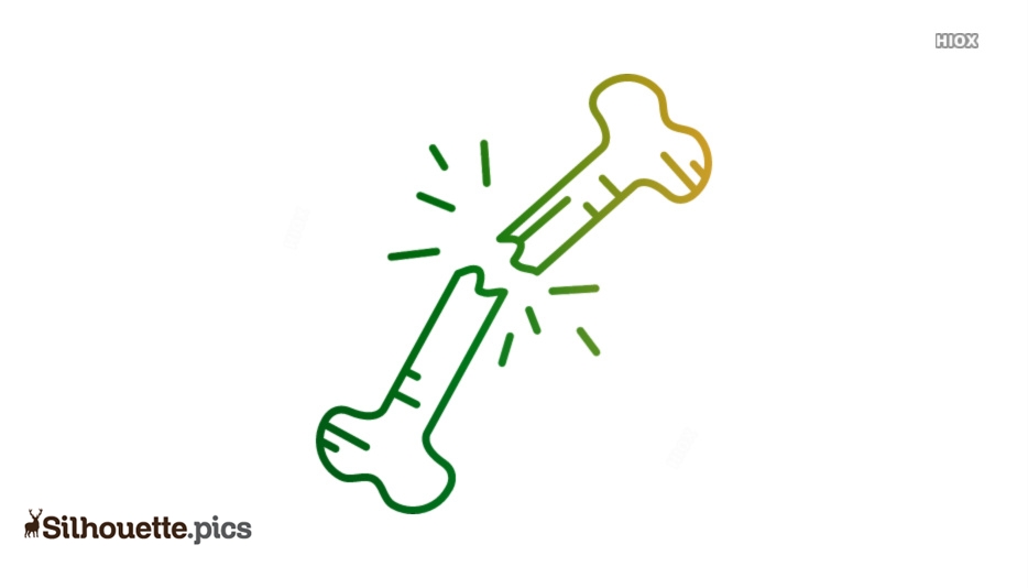 934x534 Broken Bone Silhouette Vector, Clipart Images, Pictures