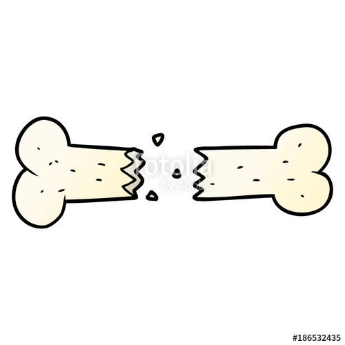 500x500 Broken Bone Cartoon Stock Image And Royalty Free Vector