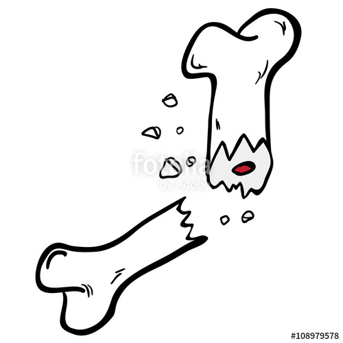 500x500 Freehand Drawn Cartoon Broken Bone Stock Image And Royalty Free
