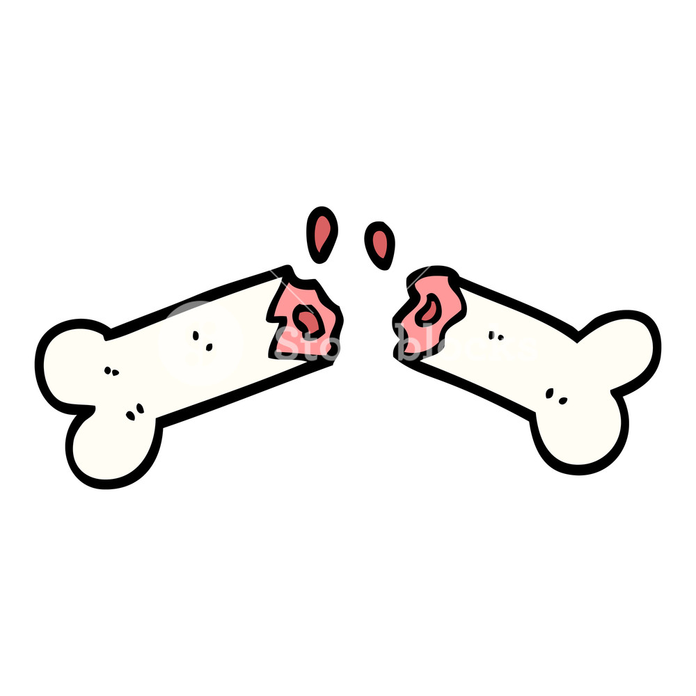 1000x1000 Hand Drawn Doodle Style Cartoon Broken Bone Royalty Free Stock
