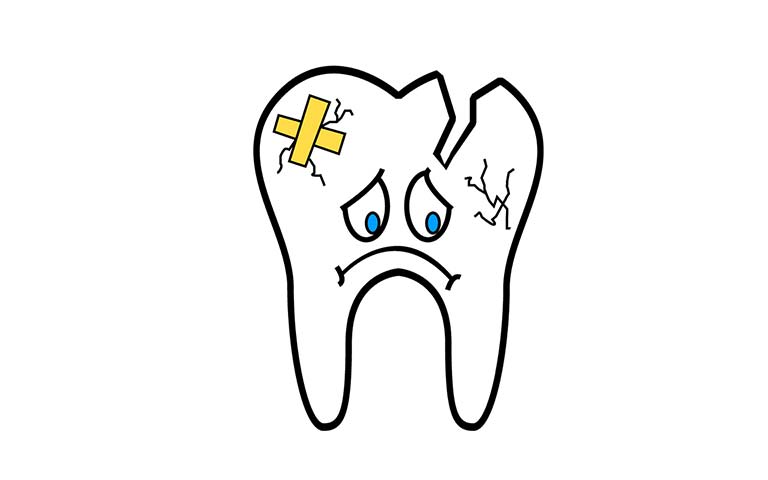 768x480 Rocky Hill Ct Chipped Tooth Repair Cromwell Broken Tooth Restoration