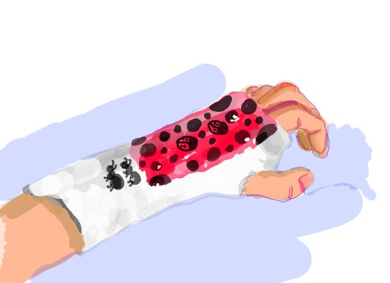550x400 My Broken Hand A Technics Speedpaint Drawing