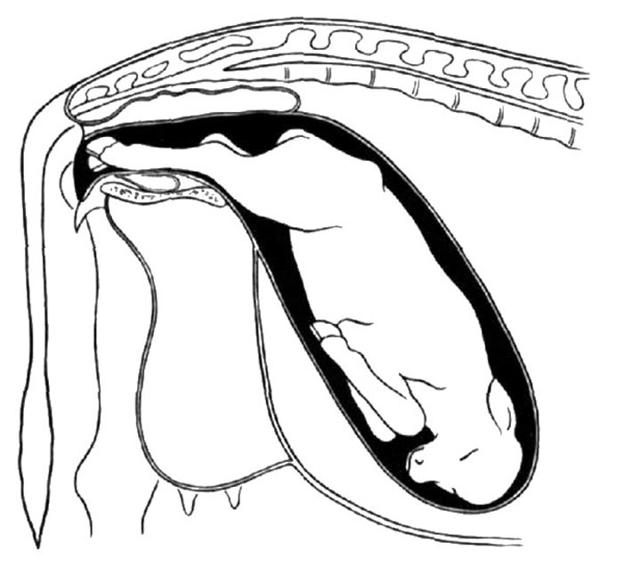 700x646 A Refresher On Calf Pulling
