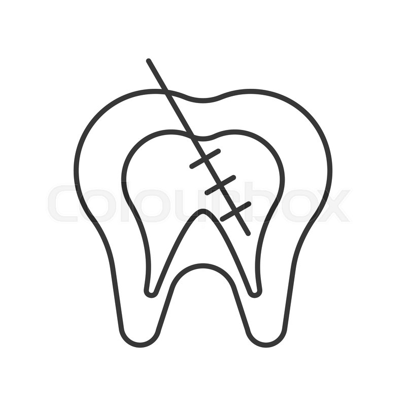 800x800 endodontic or root canal treatment stock vector colourbox