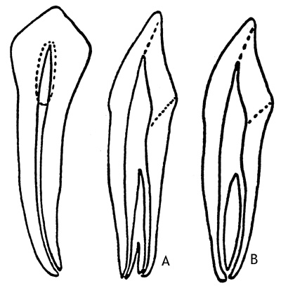 400x410 access preparation