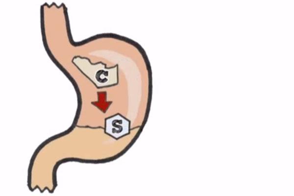 600x400 If You're Not Sure What Exactly Diabetes Is Or What It Does, This