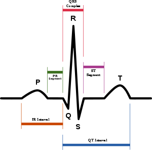 300x296 Cardiac Electrophysiology