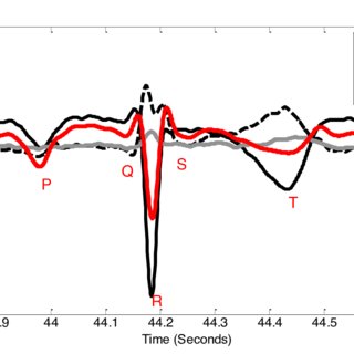320x320 Human Recording, Post Processing Wilson Central Terminal