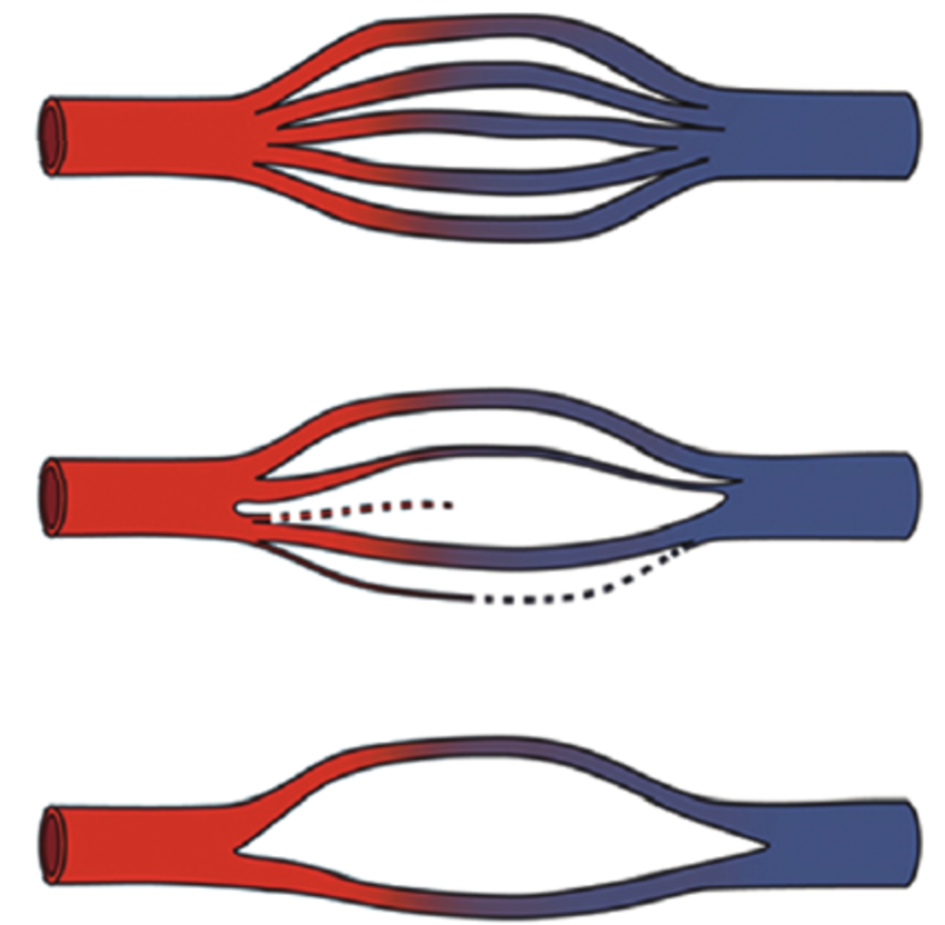 850x832 schematic drawing of string vessel development over time