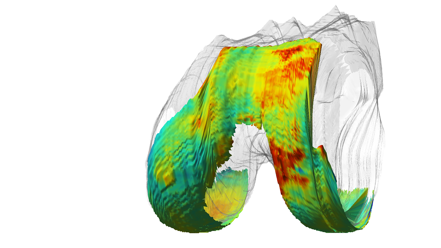 1500x844 qmri sees cartilage damage before it's too late uc san francisco