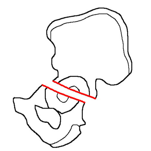 506x506 The Column Principle