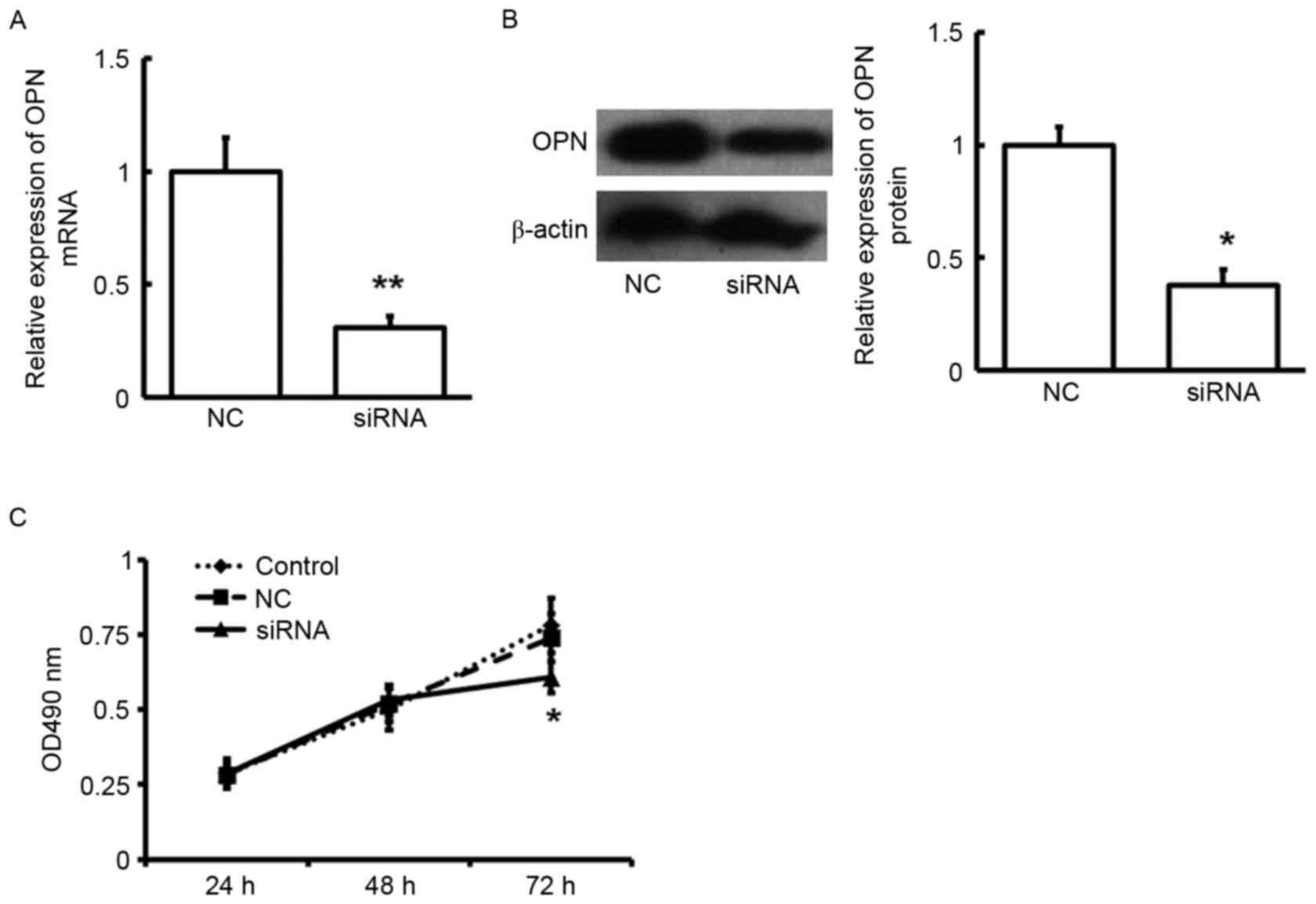 1680x1154 Roles Of Microrna And Osteopontin In Rheumatoid Arthritis