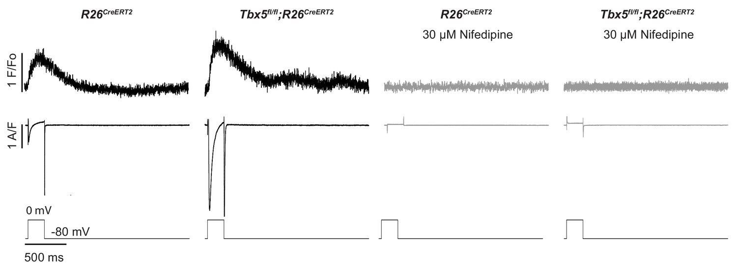 1500x539 A Calcium Transport Mechanism For Atrial Fibrillation