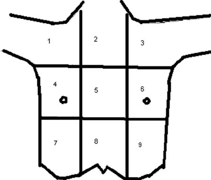 432x369 Chest Pain Location Download Scientific Diagram