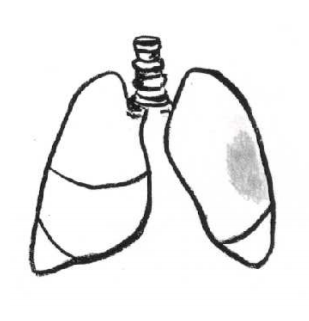 309x321 chest physiotherapy birth to years children's education materials